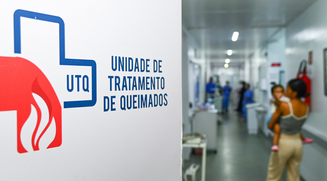 Período junino exige cuidado redobrado com relação aos riscos de queimaduras